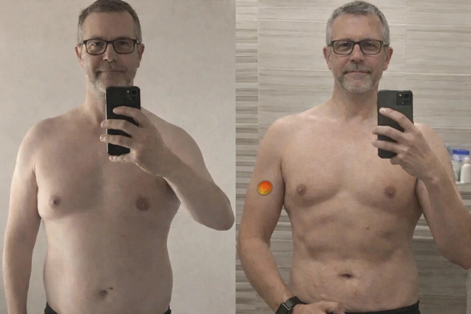 Before and after customer-style progress photo